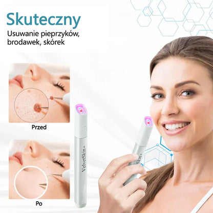 ✨ Bikenda®  – Laserowy Długopis CO₂ do Usuwania 🟤 Znamion, 🦠 Brodawek, 🔘 Przebarwień i Innych Niedoskonałości Skóry