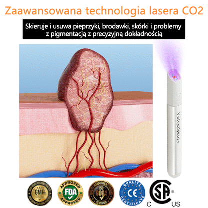 ✨ Bikenda®  – Laserowy Długopis CO₂ do Usuwania 🟤 Znamion, 🦠 Brodawek, 🔘 Przebarwień i Innych Niedoskonałości Skóry