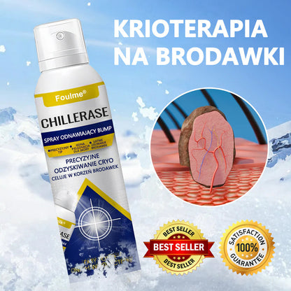 🔥Foulme® ChillErase Spray odnawiający skórę❄️