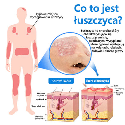 Oficjalny sklep✅: CleraLuxe®Magnezowy spray ziołowy na łuszczycę📦