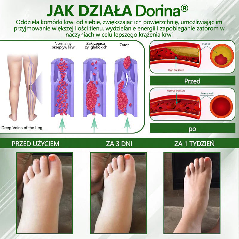 🌿🌿🌿Dorina® Krem ziołowy łagodzący obrzęki z czarnuszką
