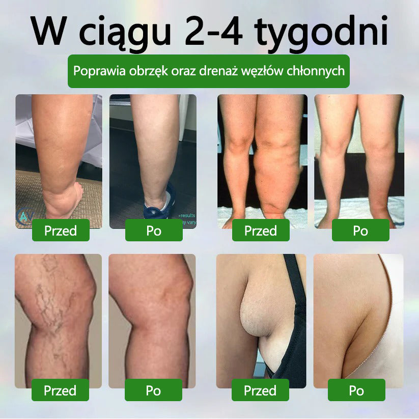 🌿🌿🌿Dorina® Krem ziołowy łagodzący obrzęki z czarnuszką