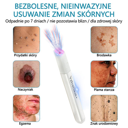✨ Bikenda®  – Laserowy Długopis CO₂ do Usuwania 🟤 Znamion, 🦠 Brodawek, 🔘 Przebarwień i Innych Niedoskonałości Skóry