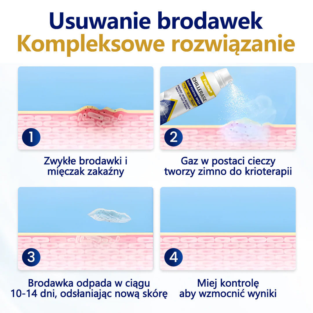 🔥Foulme® ChillErase Spray odnawiający skórę❄️