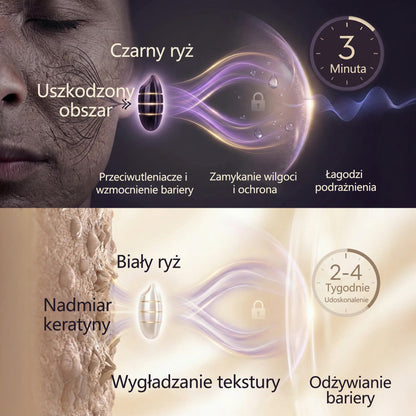 🎄 Broxie® Blemish Erase Pro – Krem do usuwania brodawek | Świąteczna edycja ❄️