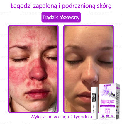 𝐉𝐚𝐬𝐬𝐞𝐞𝐦® Zaawansowany nieinwazyjny laser CO₂ do naprawy skóry 🎉 (Delikatnie usuwa brodawki, znamiona, plamy starcze i narośla skórne – bez bólu, bez zamieszania!)