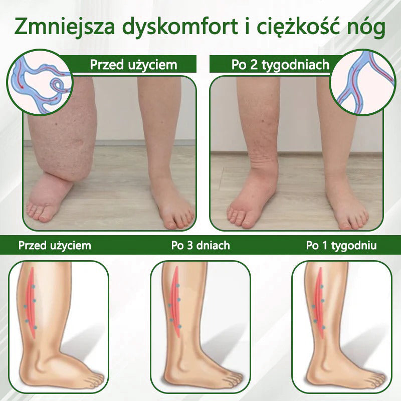 🌿🌿🌿Dorina® Krem ziołowy łagodzący obrzęki z czarnuszką