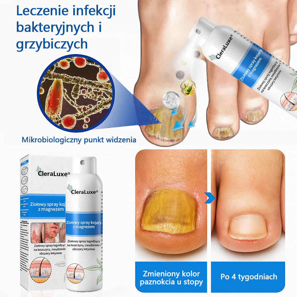 Oficjalny sklep✅: CleraLuxe®Magnezowy spray ziołowy na łuszczycę📦