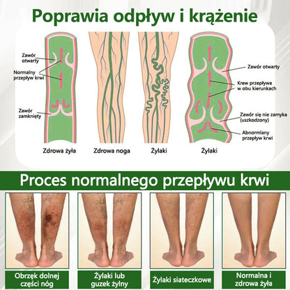 🌿🌿🌿Dorina® Krem ziołowy łagodzący obrzęki z czarnuszką