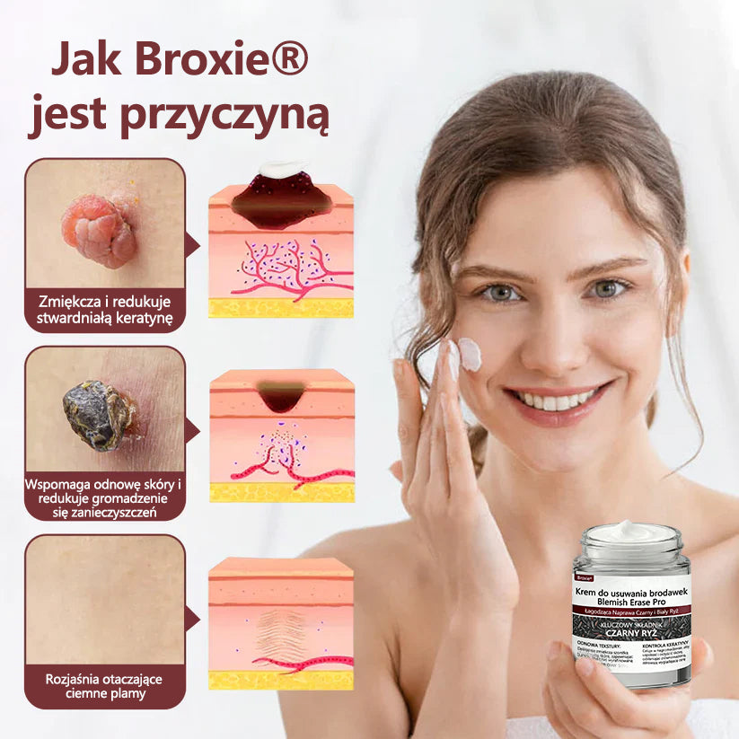 🎄 Broxie® Blemish Erase Pro – Krem do usuwania brodawek | Świąteczna edycja ❄️