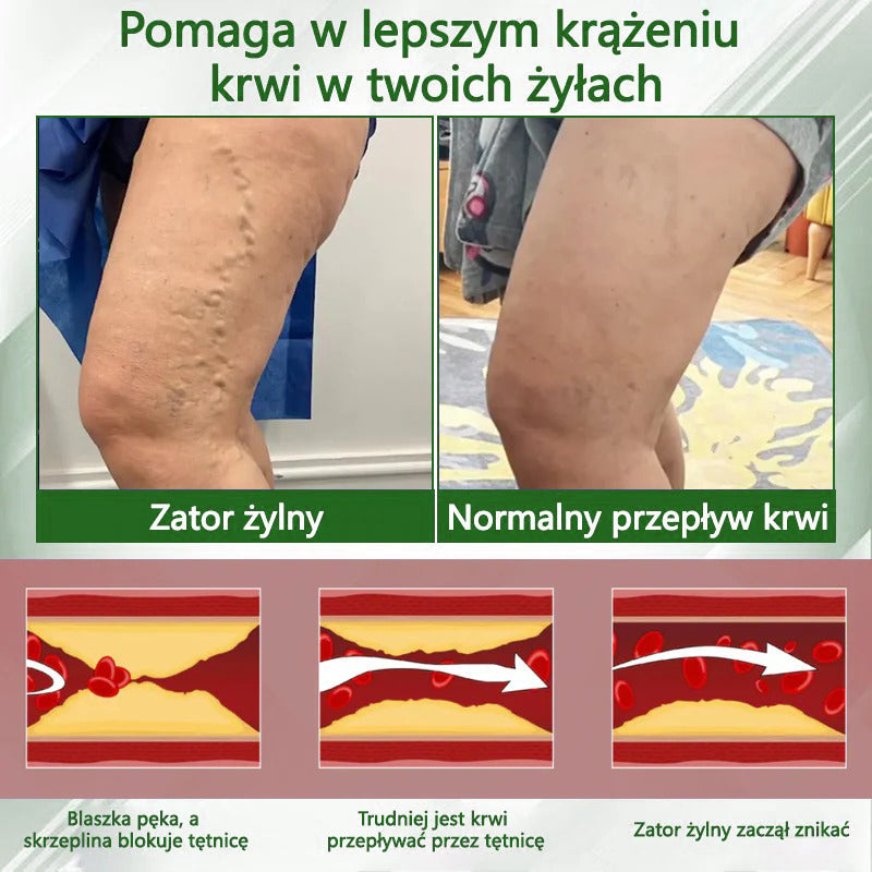 🌿🌿🌿Dorina® Krem ziołowy łagodzący obrzęki z czarnuszką