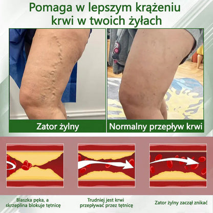 🌿🌿🌿Dorina® Krem ziołowy łagodzący obrzęki z czarnuszką