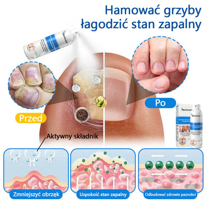 Oficjalny sklep✅: CleraLuxe®Magnezowy spray ziołowy na łuszczycę📦